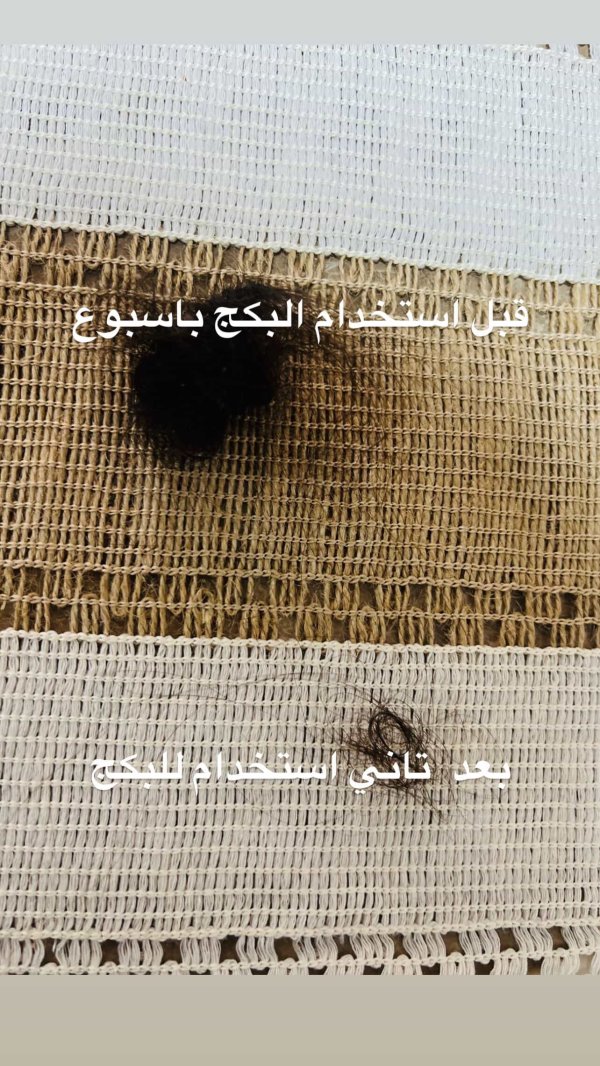 بكج الشعر والتساقط